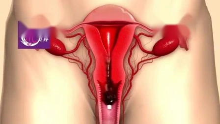 子宮膣デトックスのためのクリーンポイントタンポンを備えた女性の健康製品